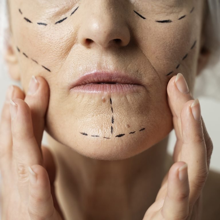 Hidroxiapatita Cálcica_2